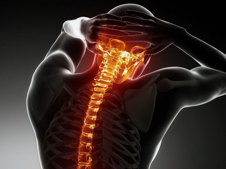 Bayyanar cututtuka na osteochondrosis