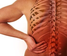 ciwon baya tare da lumbar osteochondrosis