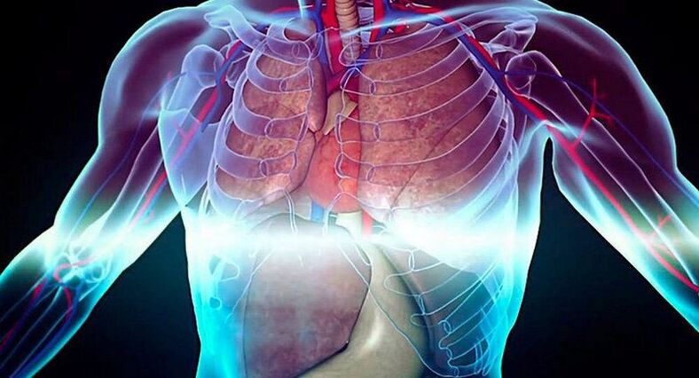 intercostal neuralgia